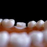 Rumor Refutation: Pay Attention to Dental Health NO.1